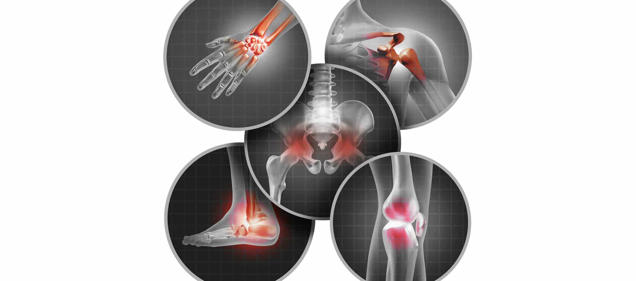 Orthopaedic surgery and sports traumatology - Pathology of sport - Trocadéro Ofice, 9 rue le Tasse 75016 Paris